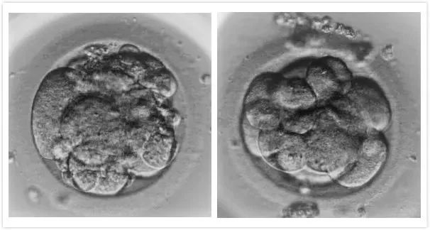 未注射线粒体非优质胚胎(左)与注射后优质胚胎(右)对比