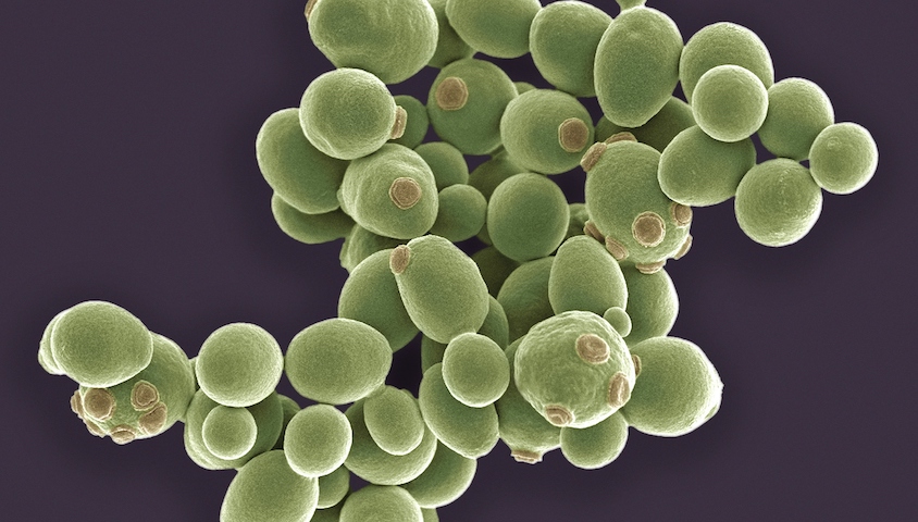 超级真菌席卷五大洲,抗生素滥用再次引发