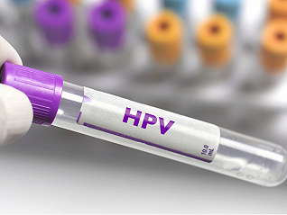 九价HPV疫苗去年供应量翻倍，但这些认知误区依然存在